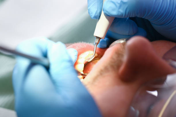 Best Pediatric Emergency Dentist in New Ellenton, SC